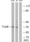 FosB Proto-Oncogene, AP-1 Transcription Factor Subunit antibody, LS-C117898, Lifespan Biosciences, Western Blot image 