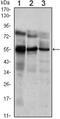 ETS Variant 5 antibody, MA5-15646, Invitrogen Antibodies, Western Blot image 
