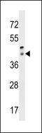 Retinal Pigment Epithelium-Derived Rhodopsin Homolog antibody, 58-618, ProSci, Western Blot image 
