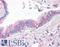 Solute Carrier Family 31 Member 1 antibody, LS-A9258, Lifespan Biosciences, Immunohistochemistry paraffin image 