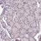 UV Stimulated Scaffold Protein A antibody, NBP2-48981, Novus Biologicals, Immunohistochemistry paraffin image 