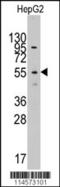 Leucine Aminopeptidase 3 antibody, 62-802, ProSci, Western Blot image 
