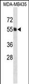 Phosphatidylinositol Glycan Anchor Biosynthesis Class A antibody, PA5-48364, Invitrogen Antibodies, Western Blot image 