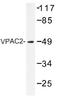 Vasoactive Intestinal Peptide Receptor 2 antibody, AP01437PU-N, Origene, Western Blot image 