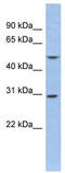 Potassium Voltage-Gated Channel Interacting Protein 2 antibody, TA338768, Origene, Western Blot image 