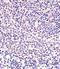 Neuropilin And Tolloid Like 1 antibody, orb2976, Biorbyt, Immunohistochemistry paraffin image 