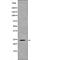 Nascent Polypeptide Associated Complex Subunit Alpha antibody, PA5-64694, Invitrogen Antibodies, Western Blot image 