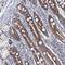 Mitochondrial Ribosomal Protein L51 antibody, NBP1-88567, Novus Biologicals, Immunohistochemistry paraffin image 