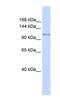 Lysine Demethylase 7A antibody, NBP1-79714, Novus Biologicals, Western Blot image 