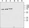 Cholinergic Receptor Nicotinic Beta 2 Subunit antibody, TA328887, Origene, Western Blot image 