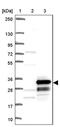 CKLF Like MARVEL Transmembrane Domain Containing 4 antibody, PA5-53218, Invitrogen Antibodies, Western Blot image 