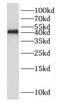 Dual Specificity Phosphatase 9 antibody, FNab02570, FineTest, Western Blot image 