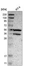 Serine/threonine-protein phosphatase 2B catalytic subunit beta isoform antibody, HPA008823, Atlas Antibodies, Western Blot image 