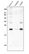 RAB8A, Member RAS Oncogene Family antibody, PA2280, Boster Biological Technology, Western Blot image 