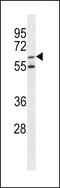 Arylsulfatase F antibody, LS-C156520, Lifespan Biosciences, Western Blot image 