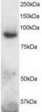 Disintegrin and metalloproteinase domain-containing protein 8 antibody, TA302779, Origene, Western Blot image 