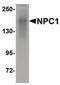NPC Intracellular Cholesterol Transporter 1 antibody, PA5-20753, Invitrogen Antibodies, Western Blot image 