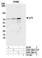 Tumor Protein P73 antibody, A300-126A, Bethyl Labs, Immunoprecipitation image 