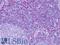 S100 Calcium Binding Protein A4 antibody, LS-B4739, Lifespan Biosciences, Immunohistochemistry frozen image 