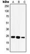Hydroxysteroid 17-Beta Dehydrogenase 10 antibody, LS-C352301, Lifespan Biosciences, Western Blot image 