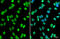 Histone Deacetylase 2 antibody, GTX109642, GeneTex, Immunocytochemistry image 