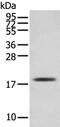 Troponin C1, Slow Skeletal And Cardiac Type antibody, PA5-51325, Invitrogen Antibodies, Western Blot image 