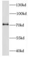 DEAD-Box Helicase 51 antibody, FNab02314, FineTest, Western Blot image 