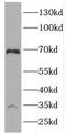 Aminoacyl TRNA Synthetase Complex Interacting Multifunctional Protein 1 antibody, FNab02750, FineTest, Western Blot image 