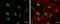 ERCC Excision Repair 6, Chromatin Remodeling Factor antibody, GTX104589, GeneTex, Immunofluorescence image 