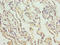 Collagen alpha-3(IV) chain antibody, LS-C285479, Lifespan Biosciences, Immunohistochemistry paraffin image 