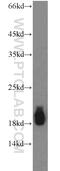 Complexin-1 antibody, 10246-2-AP, Proteintech Group, Western Blot image 