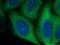 Rho Associated Coiled-Coil Containing Protein Kinase 2 antibody, 21645-1-AP, Proteintech Group, Immunofluorescence image 