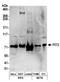 Sodium-dependent phosphate transporter 2 antibody, A304-474A, Bethyl Labs, Western Blot image 