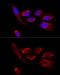 ATP synthase subunit d, mitochondrial antibody, GTX32460, GeneTex, Immunocytochemistry image 