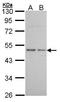 Histamine Receptor H3 antibody, GTX100187, GeneTex, Western Blot image 