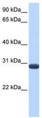 Dual Specificity Phosphatase 19 antibody, TA340253, Origene, Western Blot image 