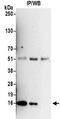 PCNA Clamp Associated Factor antibody, NBP2-32117, Novus Biologicals, Immunoprecipitation image 