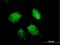 Heterogeneous Nuclear Ribonucleoprotein D antibody, H00003184-B01P, Novus Biologicals, Immunocytochemistry image 