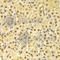 Cell Division Cycle 25A antibody, A1173, ABclonal Technology, Immunohistochemistry paraffin image 