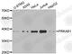 Protein Kinase AMP-Activated Non-Catalytic Subunit Beta 1 antibody, A4042, ABclonal Technology, Western Blot image 