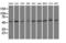 Proteasome 26S Subunit, ATPase 3 antibody, LS-C114986, Lifespan Biosciences, Western Blot image 
