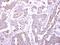 Zinc Finger And BTB Domain Containing 24 antibody, PA5-28068, Invitrogen Antibodies, Immunohistochemistry frozen image 