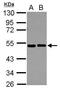 Eukaryotic translation initiation factor 2 subunit 2 antibody, PA5-30293, Invitrogen Antibodies, Western Blot image 