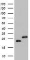 Ubiquitin Conjugating Enzyme E2 E3 antibody, TA800072S, Origene, Western Blot image 