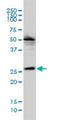 Vacuolar Protein Sorting 25 Homolog antibody, H00084313-M01, Novus Biologicals, Western Blot image 