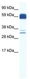 Zic Family Member 5 antibody, TA334216, Origene, Western Blot image 