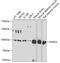 PDE5A antibody, 22-501, ProSci, Western Blot image 