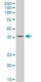 2'-5'-Oligoadenylate Synthetase 1 antibody, H00004938-D01P, Novus Biologicals, Western Blot image 