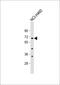 Zinc Finger Protein 813 antibody, 55-822, ProSci, Western Blot image 
