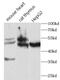 Fibroblast Growth Factor Receptor 1 antibody, FNab10417, FineTest, Western Blot image 